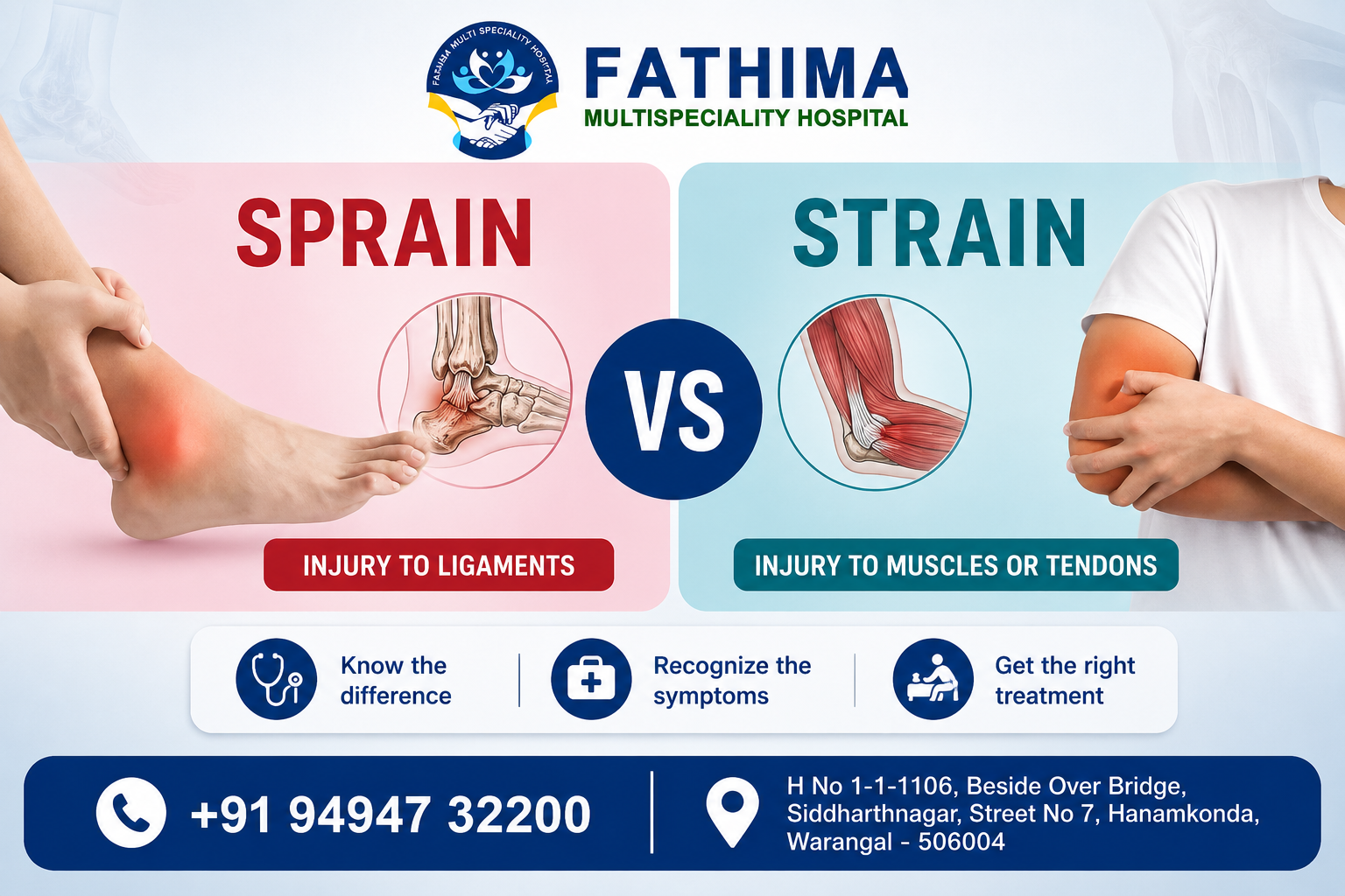 sprain vs strain